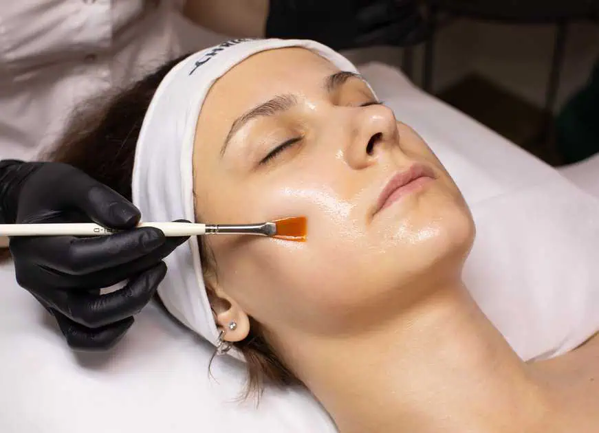 Chemical Peel Treatment in San Mateo, CA by Cosmetica Slim Med Spa