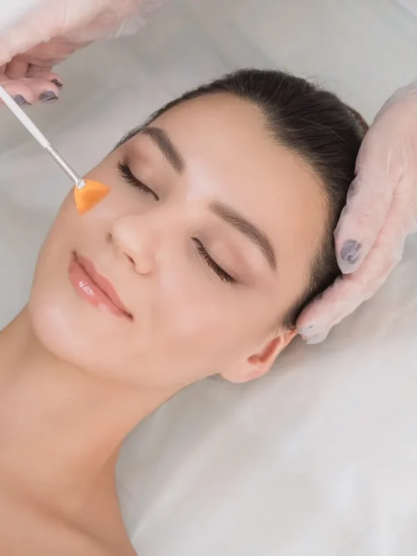 Chemical peels in San Mateo CA