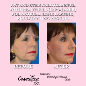 cosmeticaslimspa B&A a