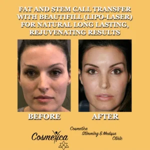 cosmeticaslimspa B&A b